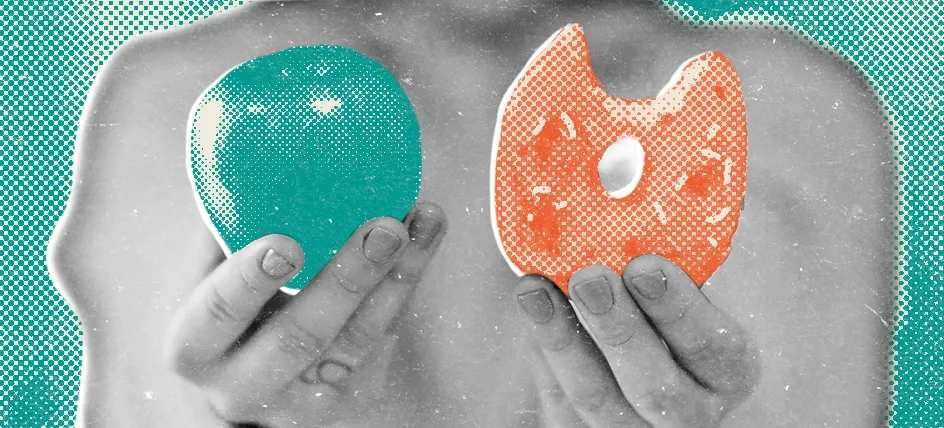 High Triglycerides: What You Need to Know for a Healthy Heart